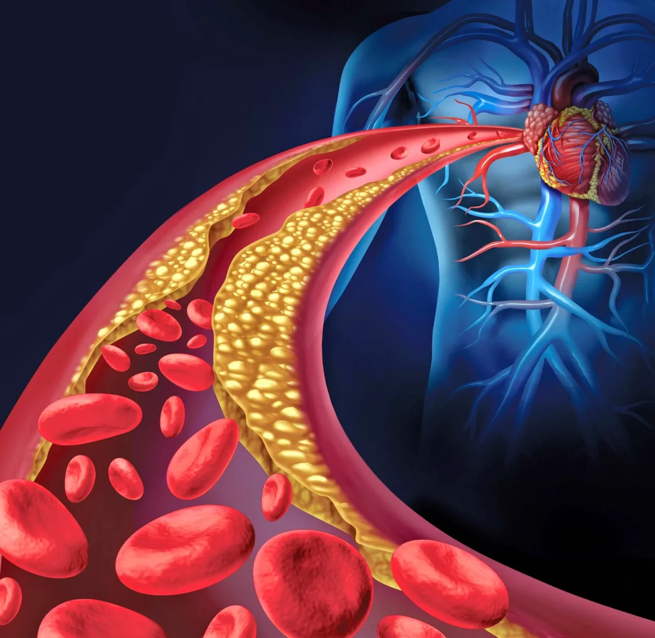 Arterie ostruite? Ecco gli alimenti che devi eliminare subito per salvare il tuo cuore